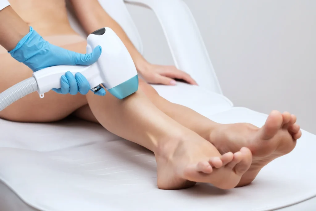 Laser hair removal on woman's legs.